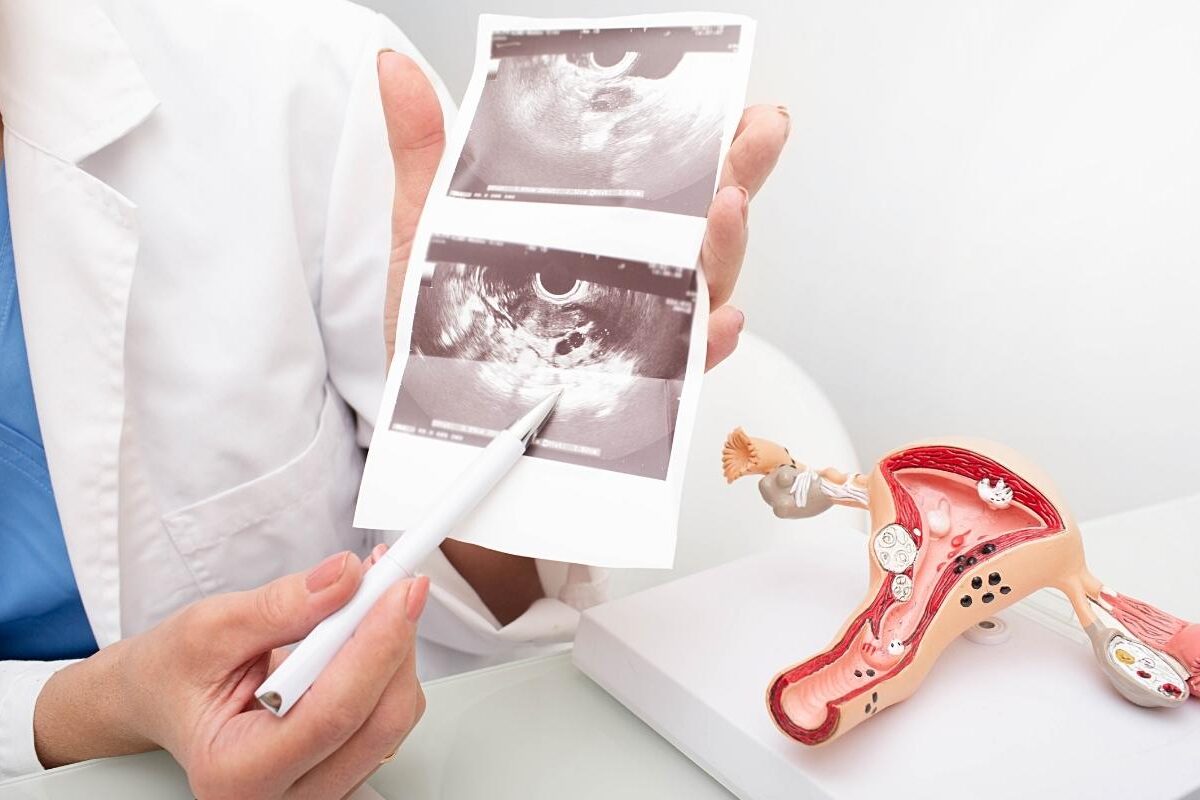 ÇikolataKistleri-01